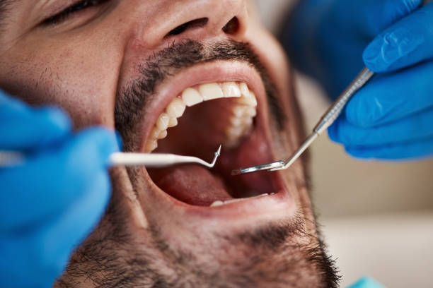 Best Tooth Infection Emergency Dentist  in Coalgate, OK